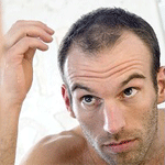 calvo La OCU denuncia los tratamientos contra la caída del cabello